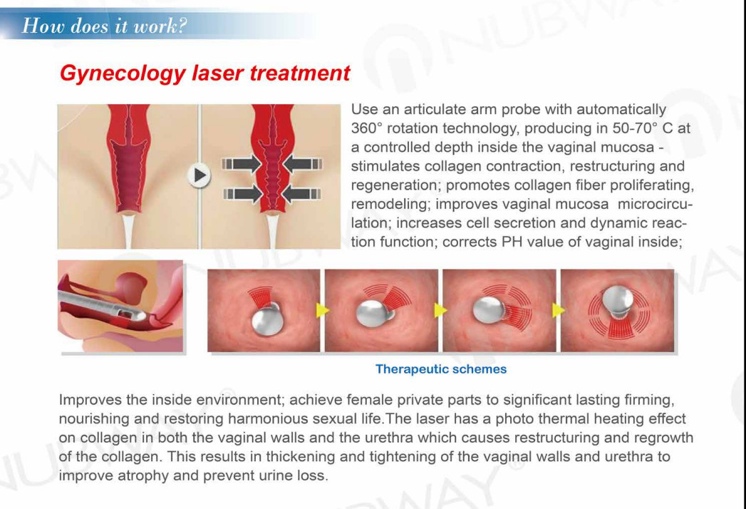 Fractional Laser CO2 Burn Debridement Treatment CO2 Fractional Laser Wrinkle Remover