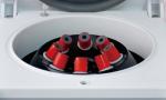Small bentchtop low speed Centrifuge , 7kg Veterinery Centrifuge, Prp centrifuge
