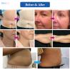 Buy cheap Touch Screen Hifu 12D Machine AC240V 60Hz for Facial And Body Slimimg Lifting from wholesalers