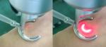 Dermatology Erbium Fractional CO2 Laser Machine Vaginal Skin Rejuvenation Laser