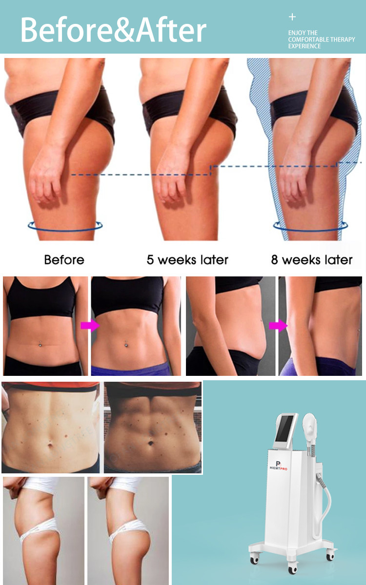 LF-446 Best Technology High Intensity Electromagnetic For Body Shape Muscle Training Machine