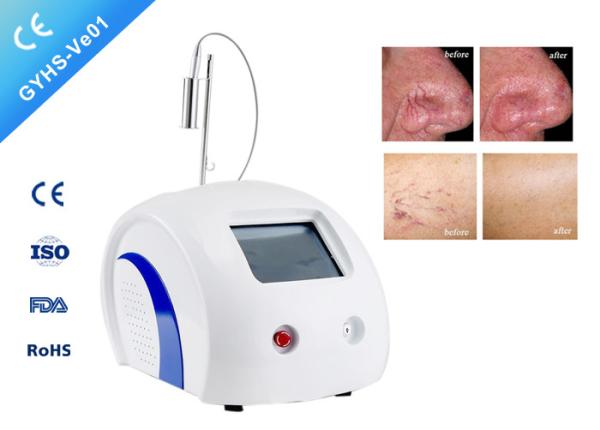 FDA Approved Laser Vein Removal Machine For Varicose Veins In Legs No Side