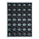 FUJI Drypix 4000/6000/8000/ Smart Using Laser Medical X-Ray Film 14x17 Inch