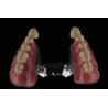 Buy cheap Stain Odor Resistant Full Acrylic Denture Natural Looking Acrylic Resin Denture Teeth from wholesalers