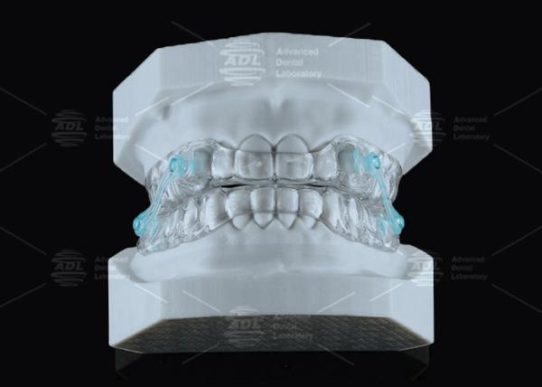 Buy cheap Transparent Erkodent Silensor Anti Snoring Mouthpiece Custom Fit Noise Reduction from wholesalers