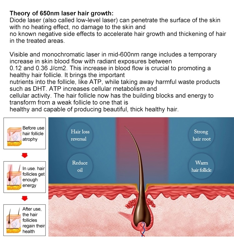 Beauty Hair Laser Regrowth Machine Diode Photodynamic Therapy Device 650nm
