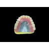 Buy cheap Cast Partial Dentures Crafted for Durability Comfort and Aesthetic and Lasts Longer from wholesalers