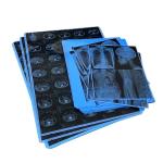 210 Microns 13X17 Inch Medical Inkjet Film High Contrast PET X Ray Film