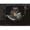 Buy cheap colorful portable Veterinary Color Doppler Ultrasound with 3 probes from wholesalers