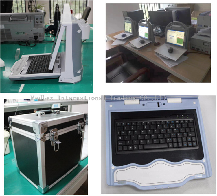 Medical Equipment Portable Automatic High Effective Ultrasound Bone Densitometer