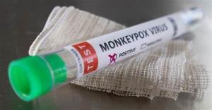 China Monkeypox Virus Detection Reagent Real Time PCR Kit on sale