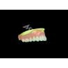 Buy cheap Cast Partial Dentures Crafted for Durability Comfort and Aesthetic and Lasts Longer from wholesalers