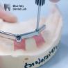 Buy cheap Acrylic Denture Dental Titanium Bar With Attachments Silver And Gold from wholesalers