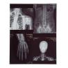 Buy cheap 210 Microns X Ray Film Medical Inkjet Laser For CT Dr Mr from wholesalers