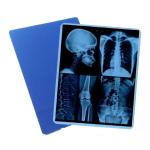 High Resolution PET Base Inkjet X Ray Film for High Printing