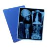 Buy cheap Medical Image System Laser X Ray Dry Film For DR CR MRI X - Ray Printer With CE ISO from wholesalers