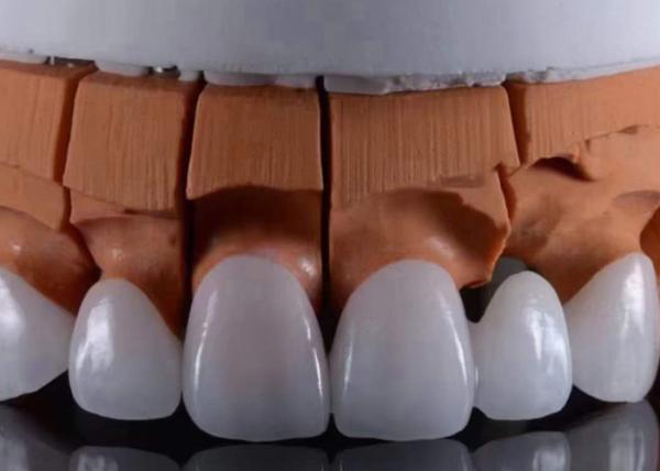 FDA Approved Translucent Zirconia dental Crowns Precise Fit with Natural