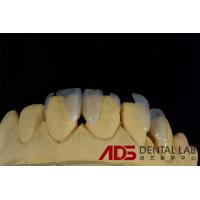 Buy cheap Dentures Aesthetic Emax All Ceramic Crowns Front Teeth OEM product