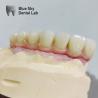 Buy cheap Customized Surgical Smooth Steam Sterilization Universal Compatibility Implant procedure cases from wholesalers