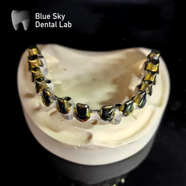 Buy cheap Gold Pure Titanium Malo Bridge Metal Frame Malo Implant Bridge from wholesalers