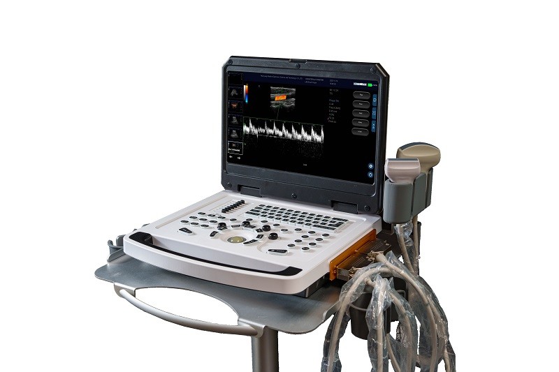 CE Portable Color Doppler Ultrasound Machine Scanner OEM