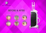 Germany Xenon Lamp Vertical SHR IPL RF Beauty Equipment 1 - 4s IPL Frequency