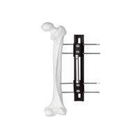 Buy cheap Medical External Fixator of bone lengthening, light and easy to do the operation product