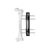 Buy cheap Medical External Fixator of bone lengthening, light and easy to do the operation from wholesalers