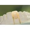 Buy cheap Natural Permanent Glass Ceramic Dental Crown For Anterior Teeth from wholesalers