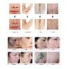 Buy cheap Medical Q Switched Nd Yag Laser Machine , Beauty Laser Tattoo Removal Machine from wholesalers