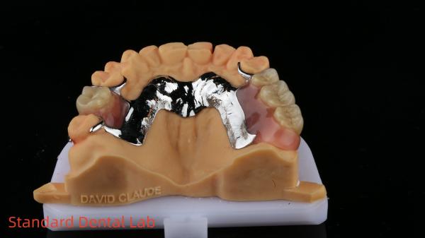 Buy cheap CorCr Metal Partial Denture High Light Beryllium Free Ivoclar Scheftner Comfortable Metal Framewrok from wholesalers