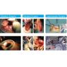 Buy cheap Medical Surgical Stapling Devices Thin Film Disposable Incision Dilator from wholesalers