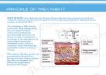 The First Chinese Manufacturer Ultrashape High Intensity Focused Ultrasound Hifu