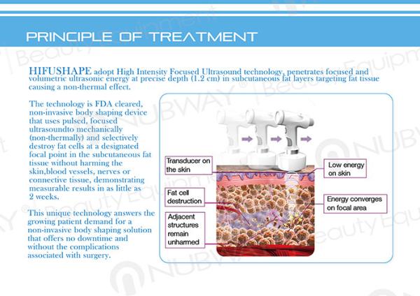 Buy cheap Beijing hifu slimming machine best non-invasive technology worldwide from wholesalers