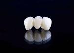 Zirconia porcelain Dental Crown with Aesthetic and Natural-Looking Finish from