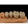 Buy cheap Premium Gold and Palladium Alloy Dental Crowns for Enhanced Durability from wholesalers