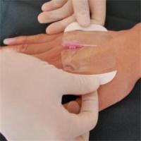 Buy cheap CE OEM Breathable Semipermeable Transparent Film Dressing For Slight Abrasions product