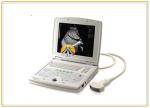 Buy cheap Digital Laptop Ultrasound Scan Machine Convex Array Probe 10.4 Inch Screen from wholesalers