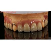 Buy cheap Heat Cured Ivoclar Partial Acrylic Denture Dental Lab High Accuracy with 3D product