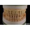 Buy cheap High Aesthetics Porcelain Layered Dental Zirconia For Implant Restorations from wholesalers