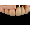 Buy cheap Titanium Sandblasted Single Tooth Replacement Implant With Gamma Irradiation Sterilization from wholesalers