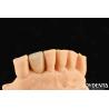 Buy cheap Dental Metal / Maryland Bridege Oral Clinical Repair Metallic Ideal Color Clinical Bonding from wholesalers