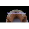 Buy cheap FDA High Esthetics Dental Zirconia Bridge With Layered Porcelain zirconia dental crown China Dental Lab from wholesalers