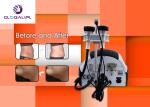 Vacuum Redundant Cellulites RF Cavitation Slimming Machine High Efficiency OEM