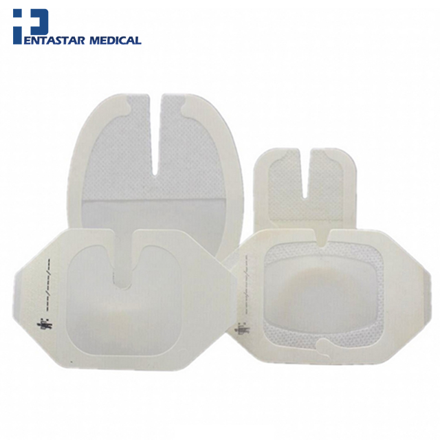 CE approved sterile bacteria wound care hydrocolloid bordered dressing for 1st and 2nd degree burn