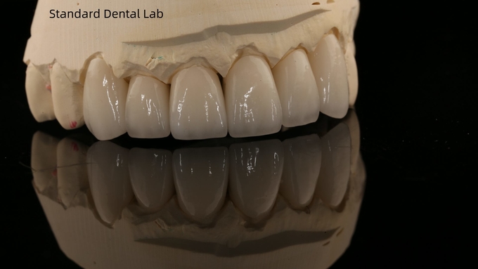 High Quality dental implant crown/bridge Zirconia Crown and All On Four Six Implant Full Arch|China dental lab 14