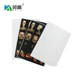 High Image Stability Inkjet X Ray Film for Glossy Surface Finish in Radiology