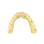 DLP Alike Temporary Crown Bridge Resin Precision Dental 3d Printing Resin