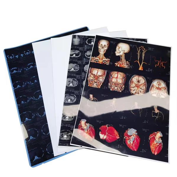 Buy cheap High Resolution Blue White Medical X ray films with Glossy Surface Finish from wholesalers
