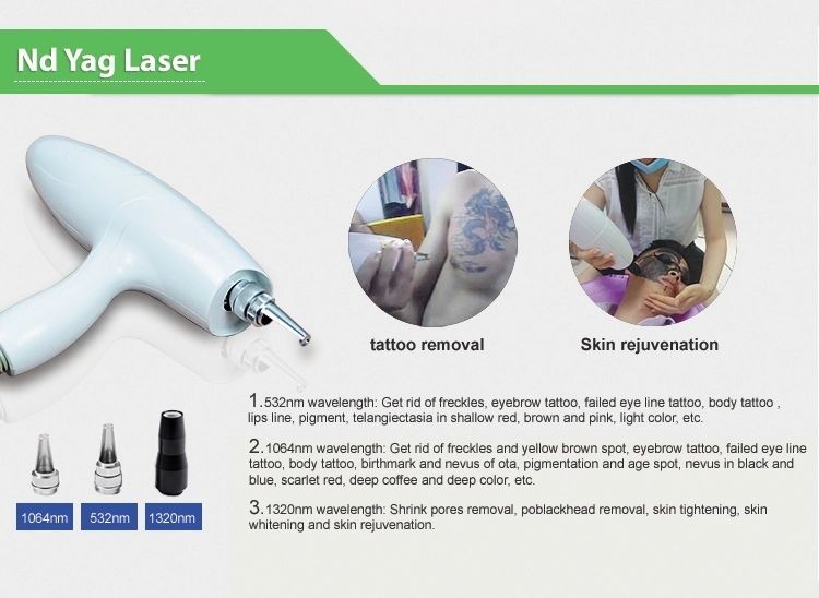 1064nm/532nm OPT IPL RF ND YAG Laser Hair Removal Machine 3 Handles